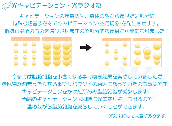 光キャビテーション・光ラジオ波